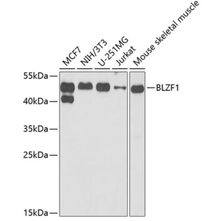 Western Blot - Anti-BLZF1 Antibody (A15223) - Antibodies.com