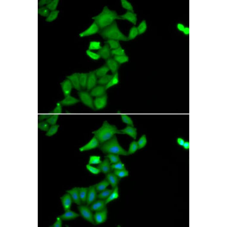 Immunofluorescence - Anti-BLZF1 Antibody (A15223) - Antibodies.com