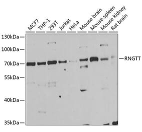 Western Blot - Anti-RNGTT Antibody (A6431) - Antibodies.com