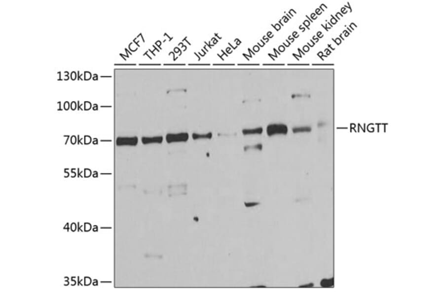 Western Blot - Anti-RNGTT Antibody (A6431) - Antibodies.com