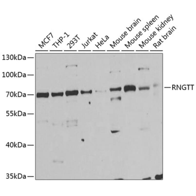 Western Blot - Anti-RNGTT Antibody (A6431) - Antibodies.com