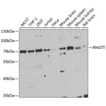 Western Blot - Anti-RNGTT Antibody (A6431) - Antibodies.com