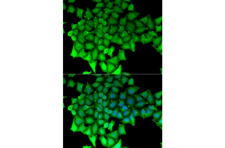Immunofluorescence - Anti-RNGTT Antibody (A6431) - Antibodies.com