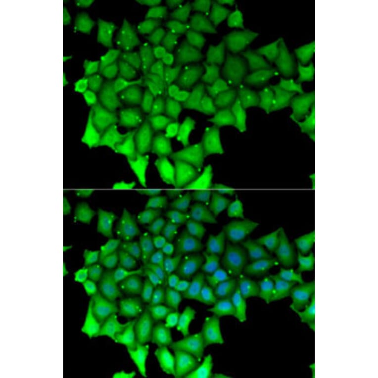 Immunofluorescence - Anti-RNGTT Antibody (A6431) - Antibodies.com