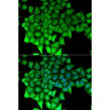 Immunofluorescence - Anti-RNGTT Antibody (A6431) - Antibodies.com