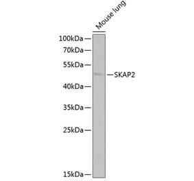 Western Blot - Anti-SKAP2 Antibody (A15226) - Antibodies.com