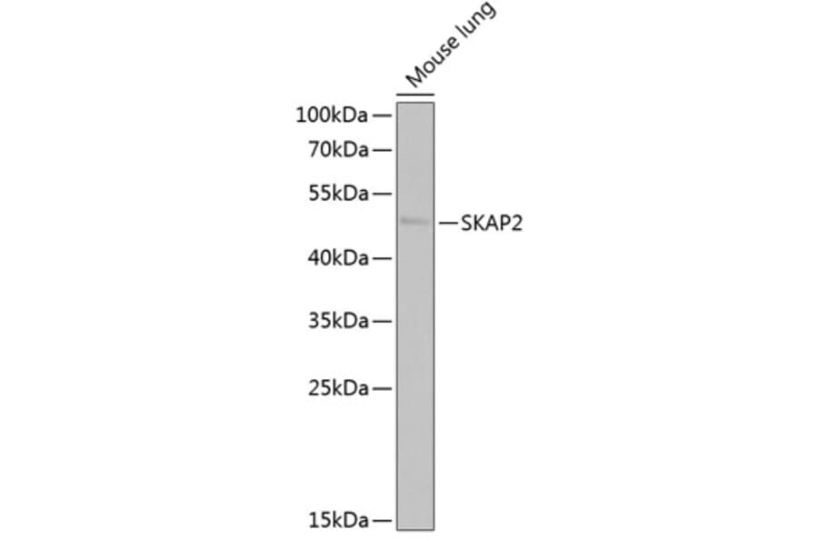 Western Blot - Anti-SKAP2 Antibody (A15226) - Antibodies.com