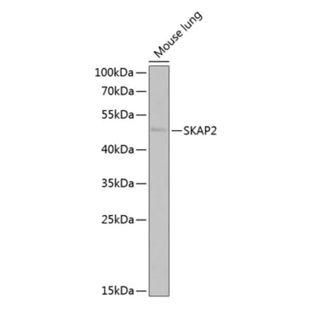 Western Blot - Anti-SKAP2 Antibody (A15226) - Antibodies.com