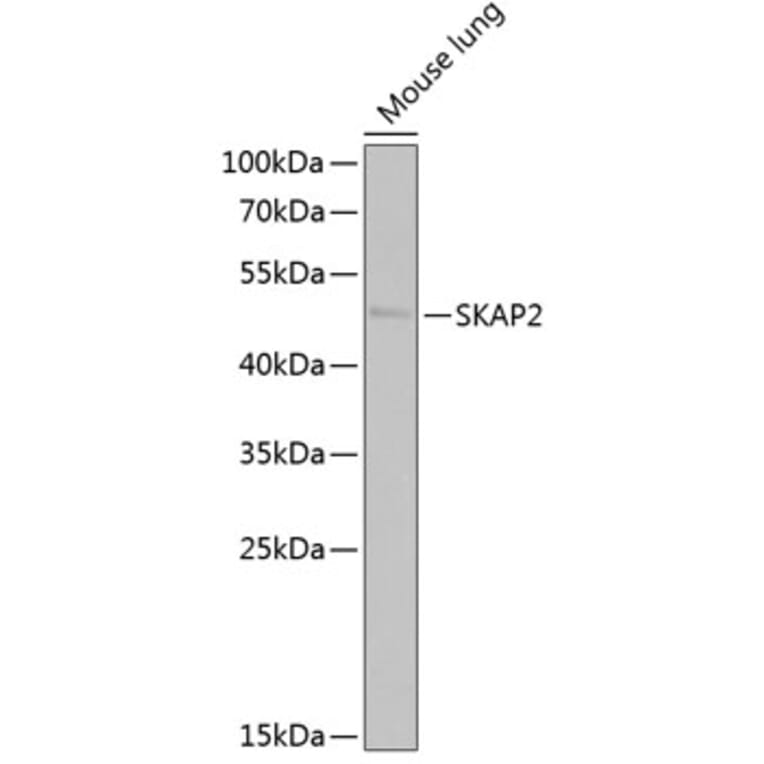 Western Blot - Anti-SKAP2 Antibody (A15226) - Antibodies.com