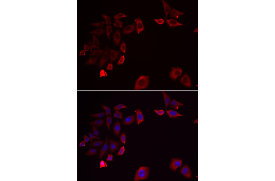 Immunofluorescence - Anti-SKAP2 Antibody (A15226) - Antibodies.com