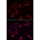 Immunofluorescence - Anti-SKAP2 Antibody (A15226) - Antibodies.com