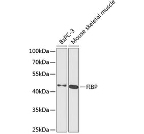 Western Blot - Anti-FIBP Antibody (A15227) - Antibodies.com