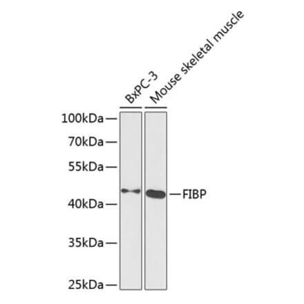 Western Blot - Anti-FIBP Antibody (A15227) - Antibodies.com