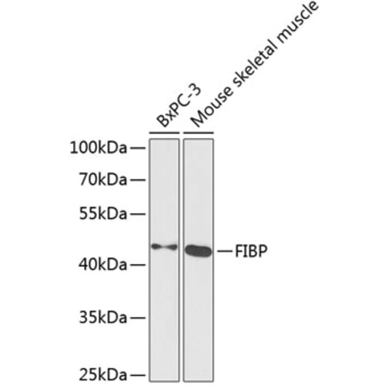 Western Blot - Anti-FIBP Antibody (A15227) - Antibodies.com