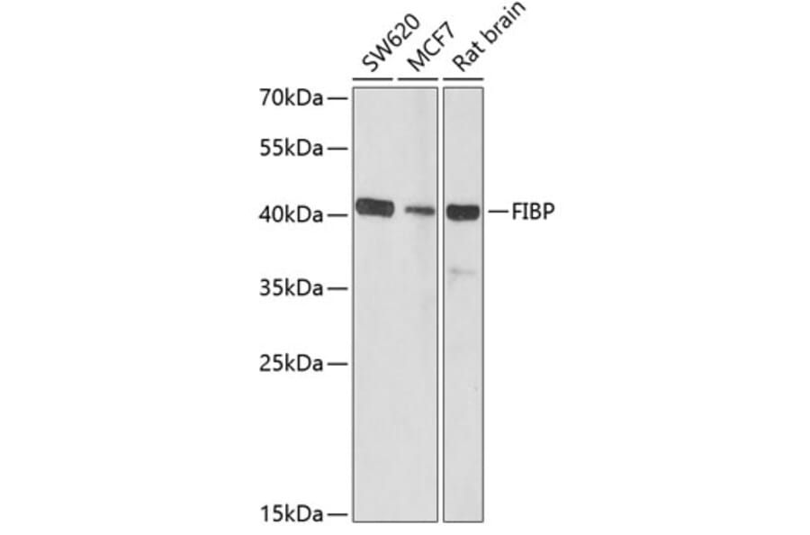 Western Blot - Anti-FIBP Antibody (A15227) - Antibodies.com