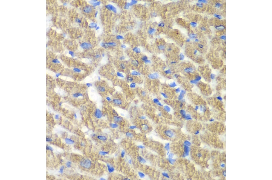 Immunohistochemistry - Anti-FIBP Antibody (A15227) - Antibodies.com