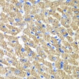 Immunohistochemistry - Anti-FIBP Antibody (A15227) - Antibodies.com