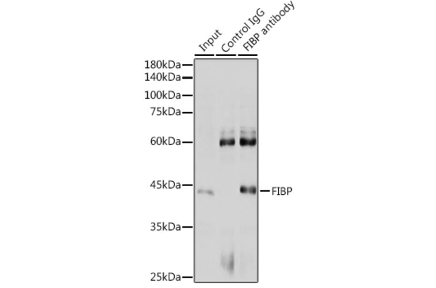 Immunoprecipitation - Anti-FIBP Antibody (A15227) - Antibodies.com