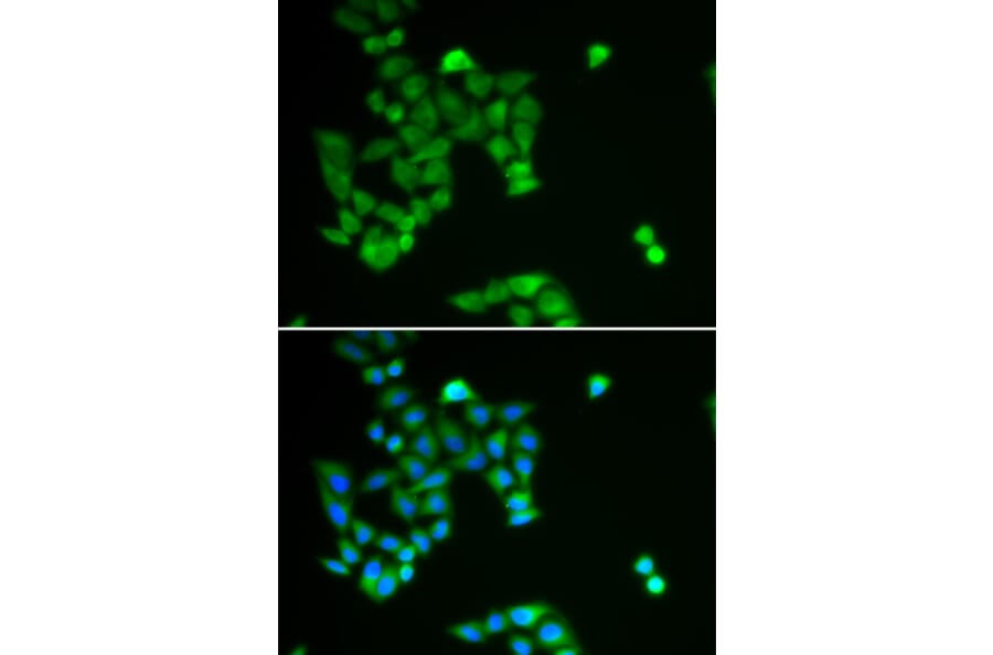 Immunofluorescence - Anti-PJA2 Antibody (A6444) - Antibodies.com