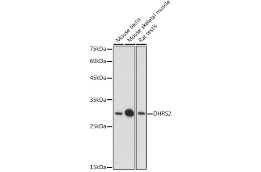 Western Blot - Anti-DHRS2 Antibody (A15230) - Antibodies.com