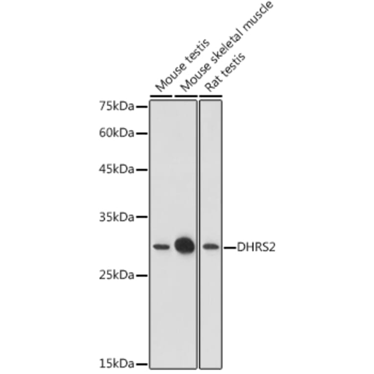 Western Blot - Anti-DHRS2 Antibody (A15230) - Antibodies.com