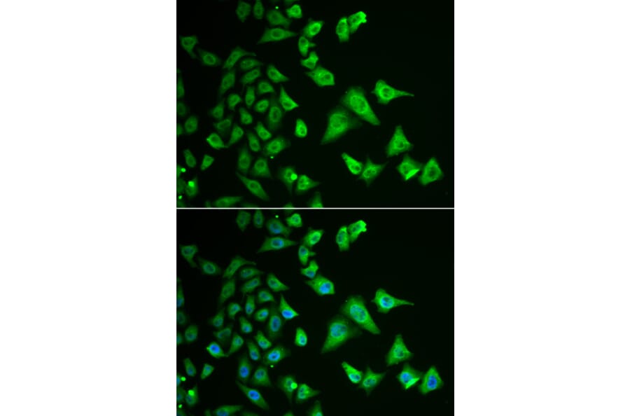 Immunofluorescence - Anti-DHRS2 Antibody (A15230) - Antibodies.com