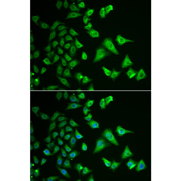 Immunofluorescence - Anti-DHRS2 Antibody (A15230) - Antibodies.com