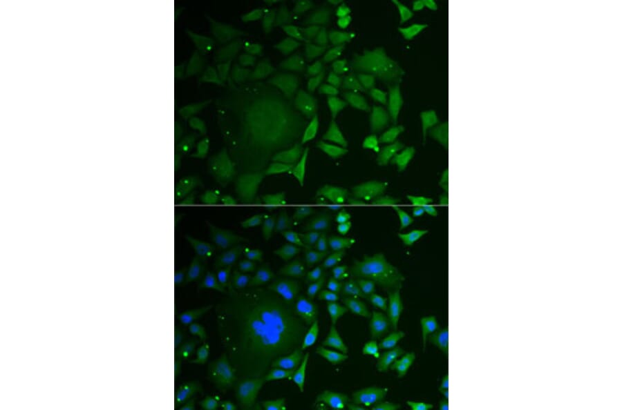 Immunofluorescence - Anti-C1D Antibody (A6448) - Antibodies.com
