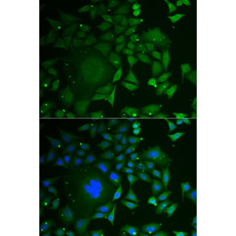 Immunofluorescence - Anti-C1D Antibody (A6448) - Antibodies.com