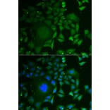 Immunofluorescence - Anti-C1D Antibody (A6448) - Antibodies.com