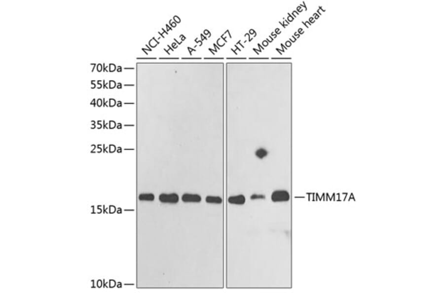 Western Blot - Anti-TIMM17A/TIM17 Antibody (A15232) - Antibodies.com