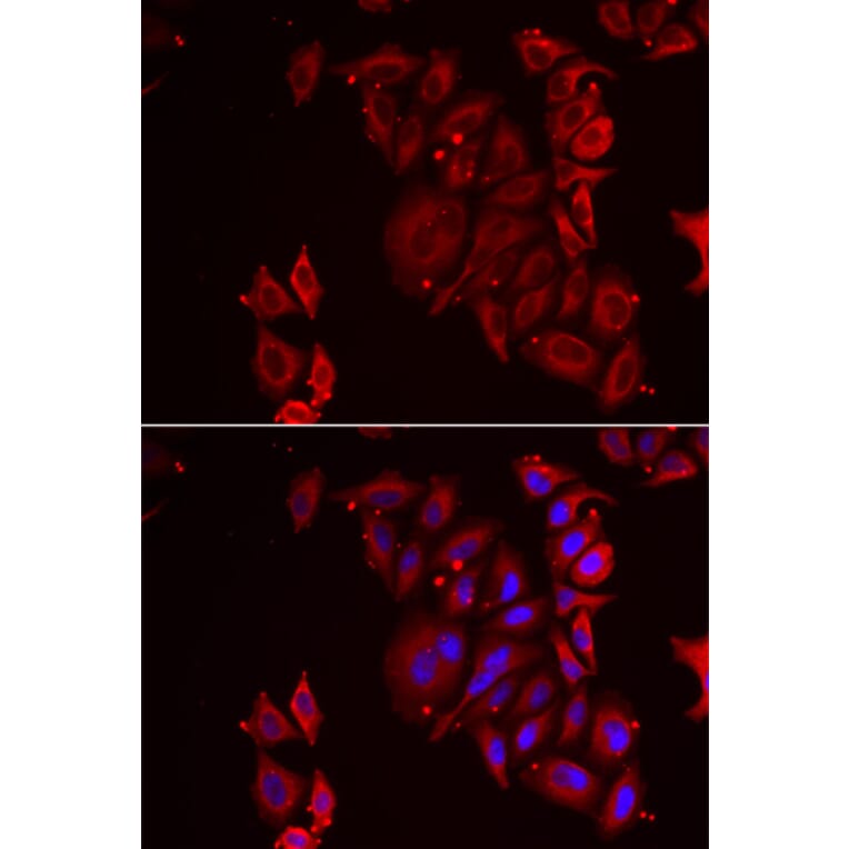 Immunofluorescence - Anti-PAICS/PAIS Antibody (A15233) - Antibodies.com