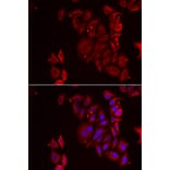 Immunofluorescence - Anti-PAICS/PAIS Antibody (A15233) - Antibodies.com