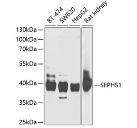 Western Blot - Anti-Selenophosphate synthetase 1 Antibody (A15234) - Antibodies.com