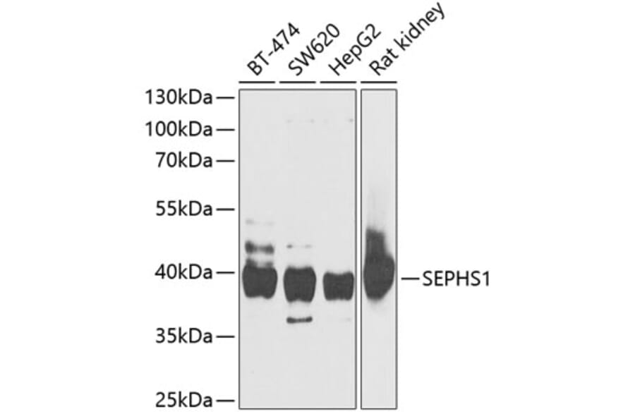 Western Blot - Anti-Selenophosphate synthetase 1 Antibody (A15234) - Antibodies.com