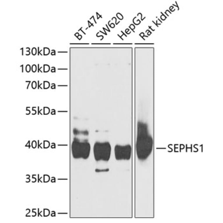 Western Blot - Anti-Selenophosphate synthetase 1 Antibody (A15234) - Antibodies.com