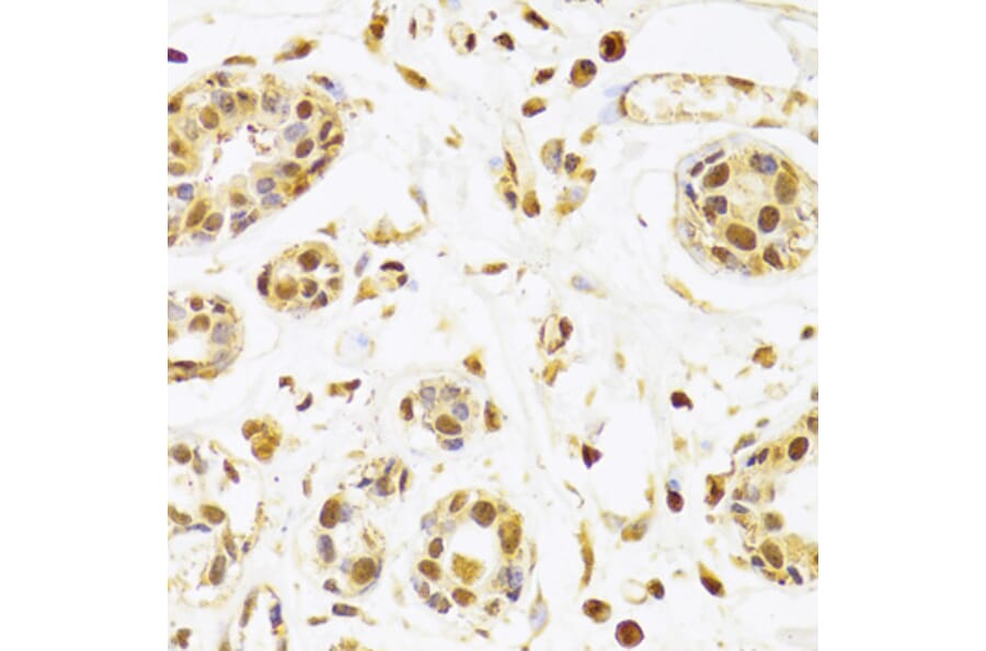 Immunohistochemistry - Anti-Selenophosphate synthetase 1 Antibody (A15234) - Antibodies.com