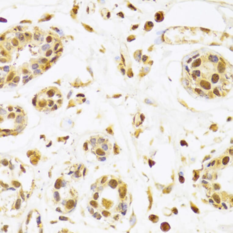 Immunohistochemistry - Anti-Selenophosphate synthetase 1 Antibody (A15234) - Antibodies.com