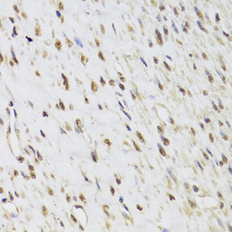 Immunohistochemistry - Anti-Selenophosphate synthetase 1 Antibody (A15234) - Antibodies.com