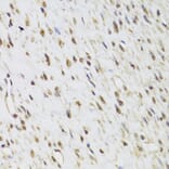 Immunohistochemistry - Anti-Selenophosphate synthetase 1 Antibody (A15234) - Antibodies.com