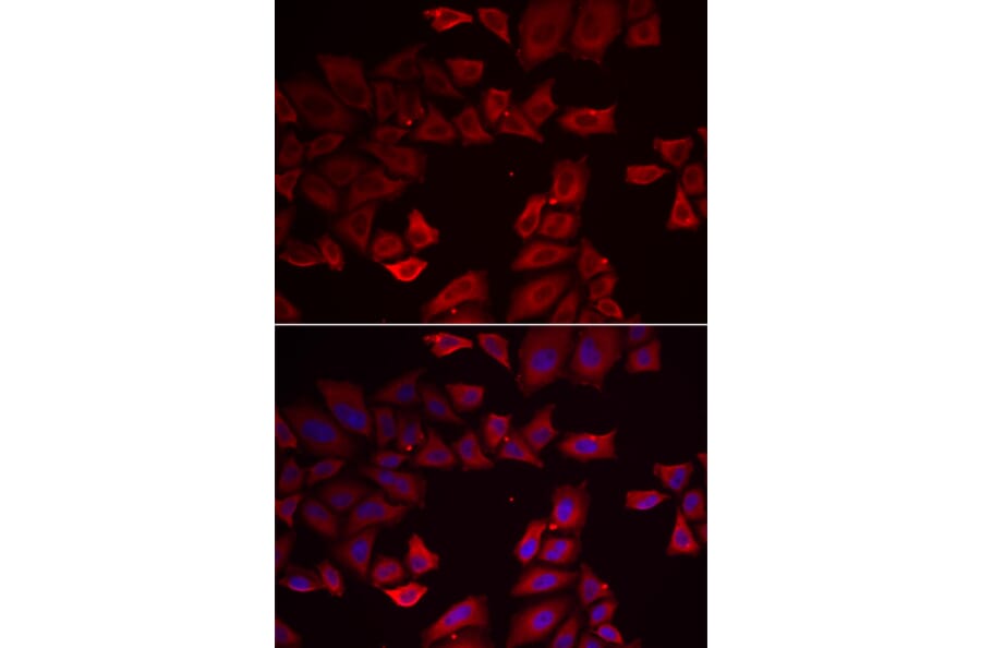 Immunofluorescence - Anti-Selenophosphate synthetase 1 Antibody (A15234) - Antibodies.com