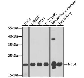 Western Blot - Anti-NCS1 Antibody (A15235) - Antibodies.com