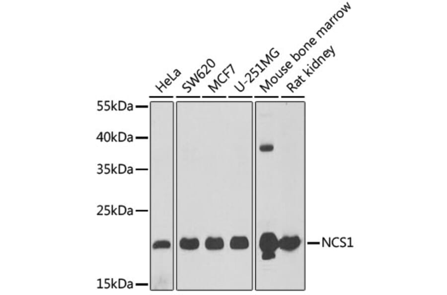 Western Blot - Anti-NCS1 Antibody (A15235) - Antibodies.com