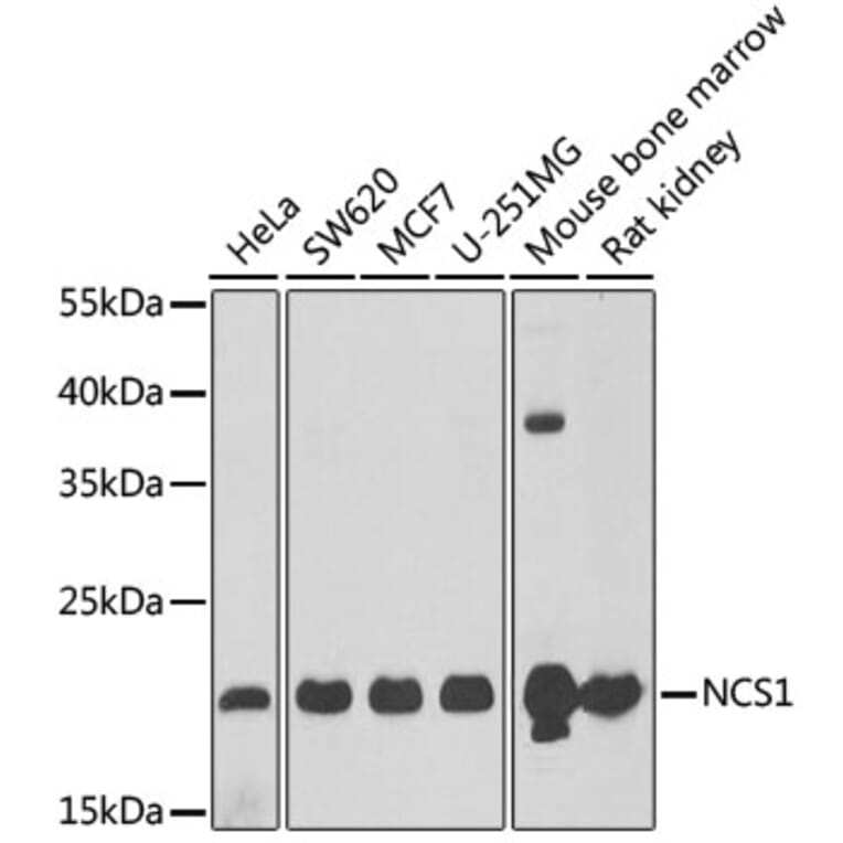 Western Blot - Anti-NCS1 Antibody (A15235) - Antibodies.com