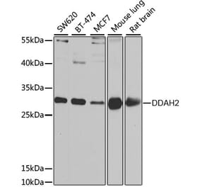 Western Blot - Anti-DDAH2 Antibody (A15236) - Antibodies.com