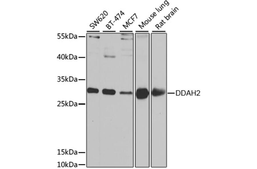 Western Blot - Anti-DDAH2 Antibody (A15236) - Antibodies.com