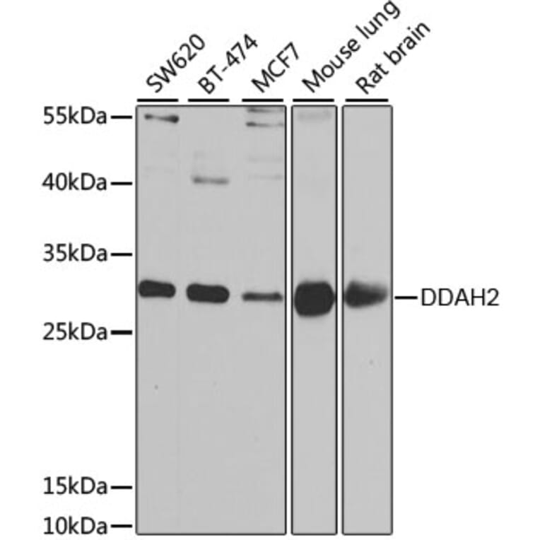 Western Blot - Anti-DDAH2 Antibody (A15236) - Antibodies.com