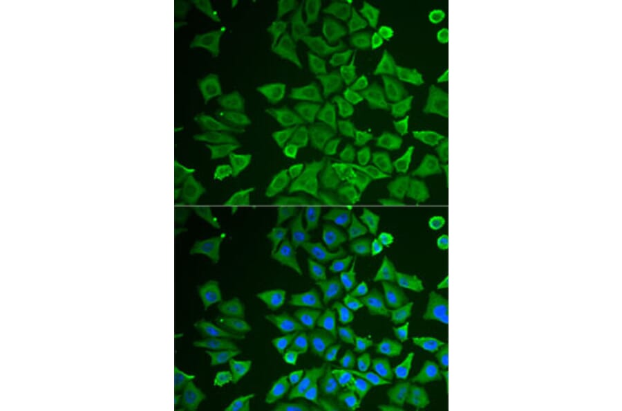 Immunofluorescence - Anti-DDAH2 Antibody (A15236) - Antibodies.com