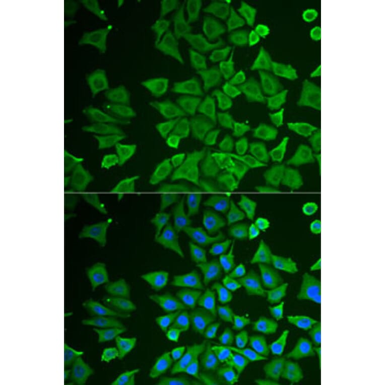 Immunofluorescence - Anti-DDAH2 Antibody (A15236) - Antibodies.com
