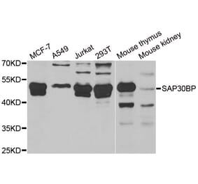 Western Blot - Anti-SAP30BP Antibody (A15237) - Antibodies.com
